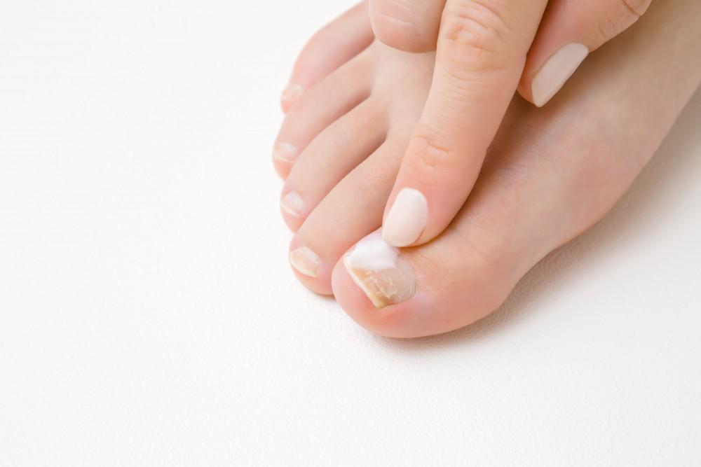 foot nail color change
